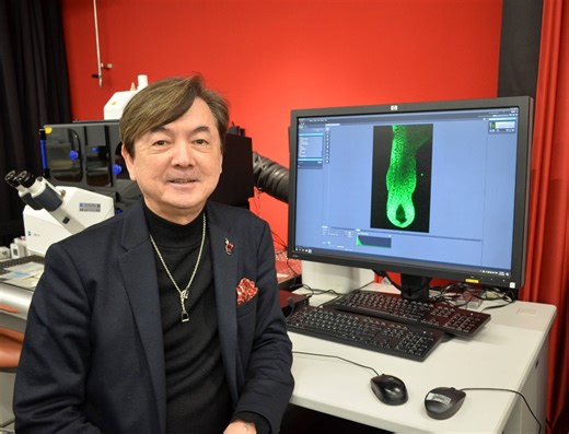 Japan-led cell discovery hints at potential new treatments for hair loss