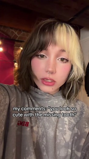 are we about to kith?🥴 fake prosthetic tooth/denture :3 | teeth