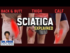 Sciatica Deep Dive: Why Your Back, Butt & Leg Hurts and How to STOP It With a 4-Step Fix!