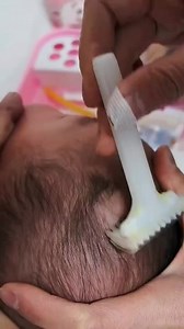 The child's parents are heartbroken, there is nothing they can do. ..flying needle phlebotomy practice phlebotomy flicking needle phlebotomy tutorial 21 g needle phlebotomy flicking needle into arm throwing needle technique phlebotomy flick technique phlebotomy | health is priceless