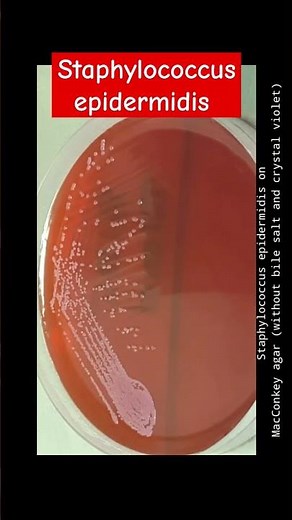 Staphylococcus epidermidis growth on various culture media, wet mount and Gram Staining