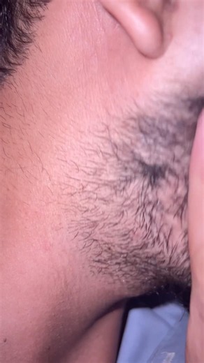 #haircare #asmrbeard #ingrownhairremoval #removeingrown #satisfying #oddlysatisfying #blackheads