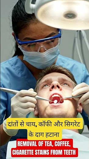 Teeth Scaling & Polishing Procedure | Complete Dental Cleaning ‪@drgautam93‬ CALL 7006672655