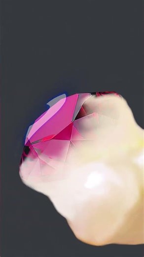 [ASMR] Zombie mouth stone treatment/oral stone, stomatitis, tonsillitis treatment animation asmr