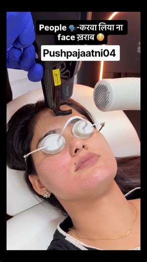Pushpa jaatni ka scar treatment at Dr Ritu Sangwan clinic 90686-34000 #drritusangwan#pushpajaatni04