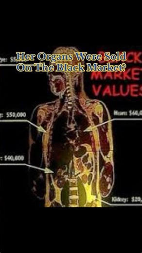 Her Organs Were Sold On The BIack Market? #disturbing