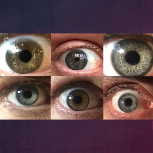 117K views · 3.5K reactions | The Surprising Way You Get Your Eye Color | Be Smart | Facebook