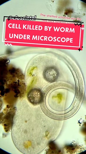 Nematodes Under Microscope: Cell Interaction Revealed