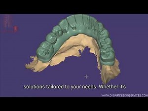 Mastering Lower Bridge design For a dental lab