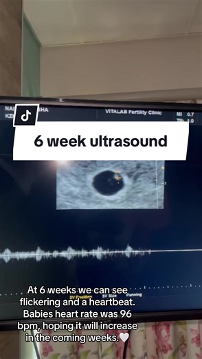 6 Week Ultrasound: Flickering Heartbeat at 96bpm