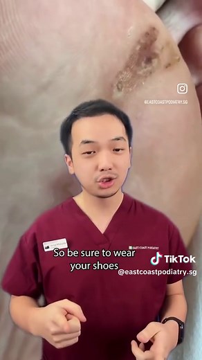 Foot Parasites: Worm Infection and Treatment