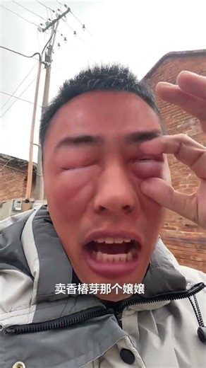 Unveiling the Secret: Lacquer Tree Buds vs. Toona Sinensis Buds