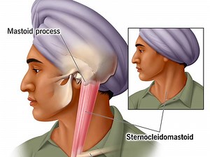 End of Part II: Muscles of the Neck
