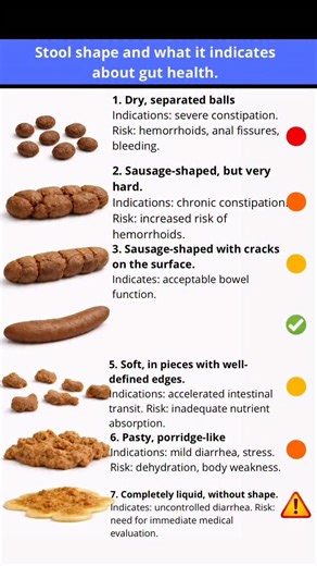 Improve your Gut Health | Stool says a lot about your health. The Bristol Stool Chart classifies our stool into 7 types. Let’s better understand each one: Type 1:... | Instagram