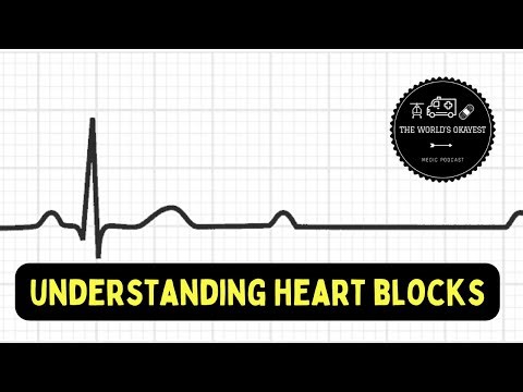 Understanding Heart Blocks (EXPLICIT)