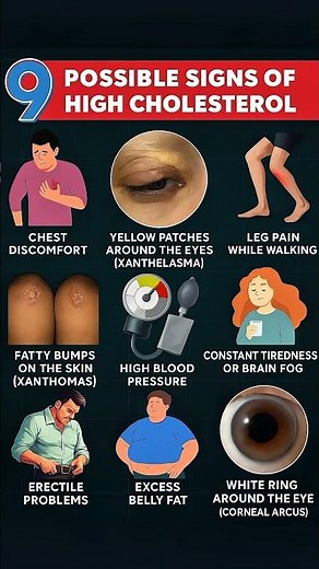 9 Possible Signs of High Cholesterol