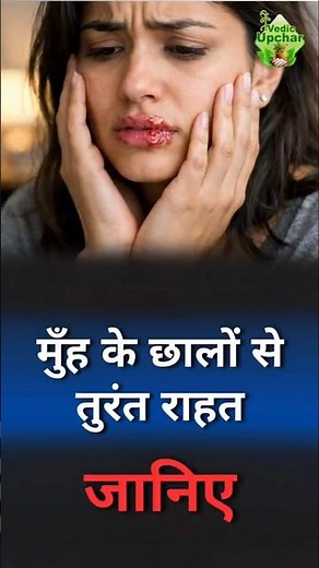 Mouth Ulcer (Muh Ke Chhale)? Try These Simple Home Remedies | Vedic Upchar | @anilbansalayurveda |