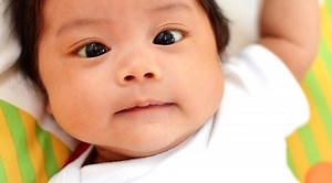 Baby and Newborn Cross Eyed: Causes and Treatment