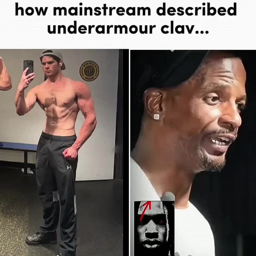 Maximizing Your Clavicular Aesthetics for a Stronger Look