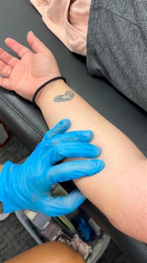 Dr. John Jowers, DPT, SCS, CSCS | Watch what her ring finger does when the electrical stim unit turns on– that’s how targeted we can get with dry needling. Dry needling is... | Instagram