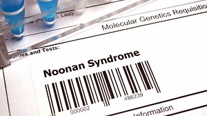 Syndrome de Noonan : une maladie pas si rare