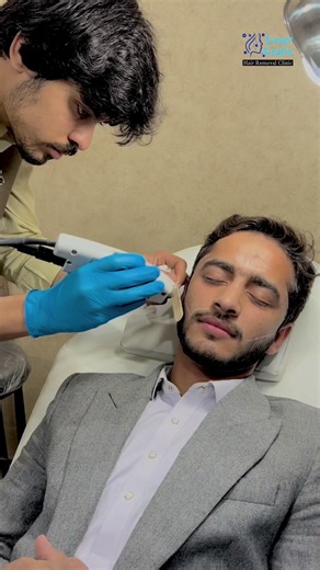 Effective Candle Laser Hair Removal by Mansoor