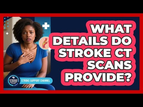 What Details Do Stroke CT Scans Provide?