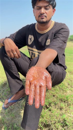 The boy demonstrates survival skills: He removes all the thorns stuck in his hand using Fevicol! 🌵