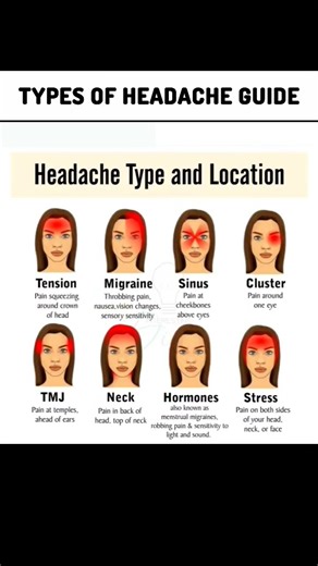 #tiktokgame#trending #eyes #funny #youtubeshorts #memes #marriage