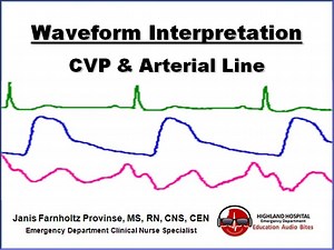 CVP & Arterial Line Waveform Interpretation