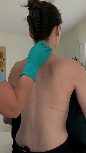 Asmr back and spine exam medical roleplay @ilovekatieasmr #asmr #asmrsounds #asmrsound #asmrtiktoks #asmrtiktok #asmrtiktoks🦋asmr🦋 #asmrtik #asmr_tingles #asmrtingles #asmrtingle #asmrdoc #asmrdoctor #asmrdoctorroleplay #asmrdoctorexam #asmrmedical #asmrmedicalroleplay #asmrmedicalexam #asmrneck #asmrmedicalroleplay #asmrback