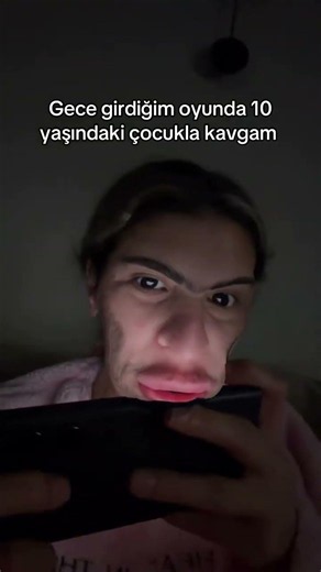 #keşfet #ytshorts #keşfetbeniöneçıkar #comedy #black #keşfetteyiz #white #ace #mylife