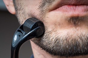 Beard Roller: Activate New Growth (Microneedle) - Bald & Beards