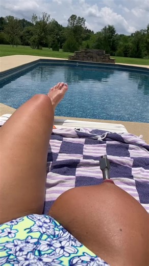 Innovative Titanium-Anchor Implant for Above-Knee Amputation