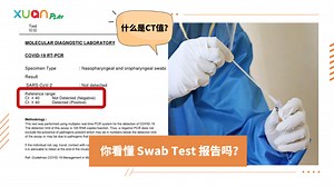 News I CT值多少算确诊？教你从CT值中看出新冠病毒传染力！