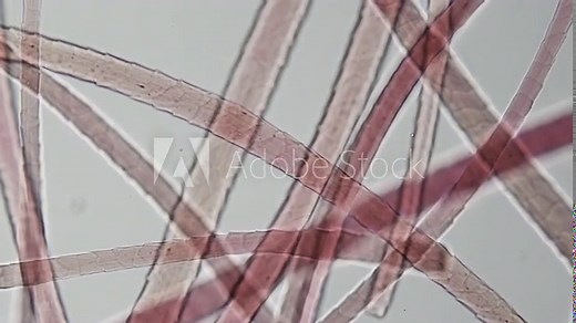 Hair under microscope. Structure of hair, consisting of keratin cells that form outer layer called cuticle, medulla in core and cortex, which forms main part of the hair. 400x times magnification