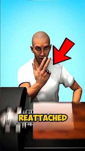 Lost a Finger… And It Grew Back?! (Not What You Think)