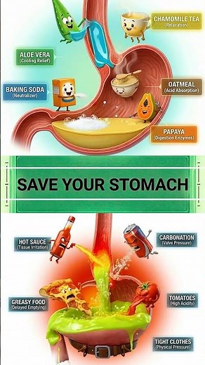 Why You Get HEARTBURN After Eating (Acid Reflux 3D) 🔥🛑