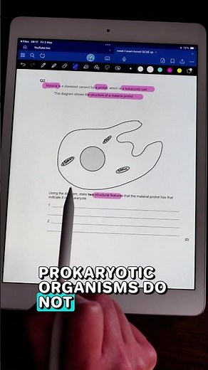 GCSE protist - Eukaryotic vs Prokaryotic Cells | A-Level Biology Exam Question 🧫
