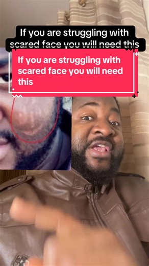 Effective Skincare Tips for Scar Management