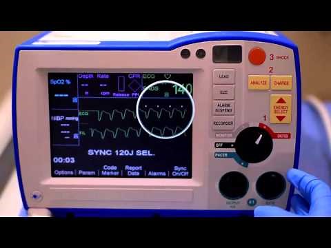 R Series Synchronized Cardioversion (Software prior to v 14)