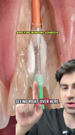 The Truth About Broken Teeth