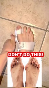 117K views · 2.3K reactions | Bunion corrector exercises! . . . Subscribe to my Youtube: https://youtube.com/@physicaltherapysession - #bunions #bunionsurgery #bunioncorrector #bunionexercise #buniontreatment #physiotherapy #physiotherapist #physio #physicaltherapy #physicaltherapist #foryou #foryoupageシ #viralvideo #newtrending | Physical Therapy Session | Facebook