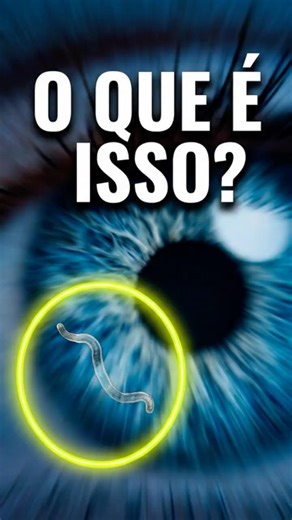 O que são essas "MINHOCAS" que flutuam na sua visão? 🪱👁️