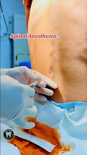 Spinalanästhesie. Anesthesia ( Spinal)