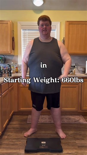 Struggling with binge eating at 445lbs | malabsorption eating