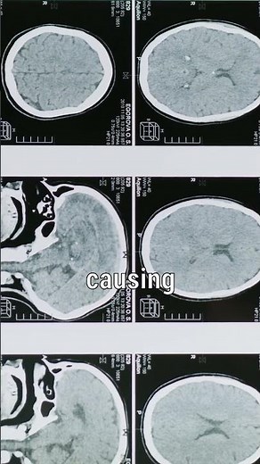 The Danger Within: Understanding the Risks of Playing with Fire