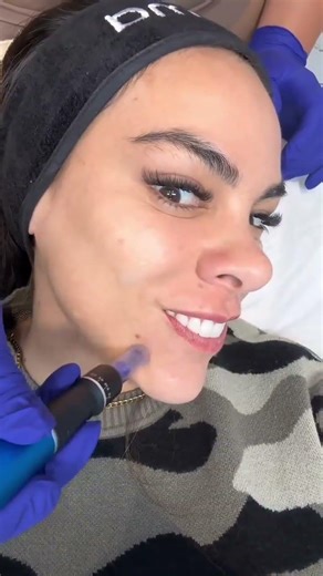 Cada año más joven con Nova Steticape 💕