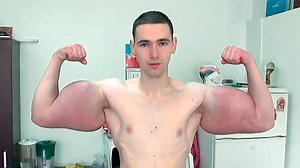 Zu schön zum Leben: Warum dieser russische “Bodybuilder” seine Hände verlieren könnte