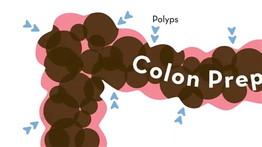 What is Colonoscopy? - Colonoscopy is a medical procedure used to examine the inside of the large intestine (colon and rectum) using a long, flexible tube called a colonoscope. Endocare is Provide Endoscopy , Colonoscopy , Bronchoscopy , Rhino Laryngoscopy , Cystroscopy , URS Machine With Good Service Support . #MedicalEducation #Endocare #endoscopy #colonoscopy #bronchoscopy #laryngoscope #cystros #gastroenterology #hepatologist #surgery | EndoCare